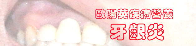 歐陽英疾病營養：牙齦炎